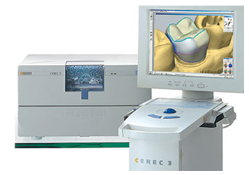 cerec-system